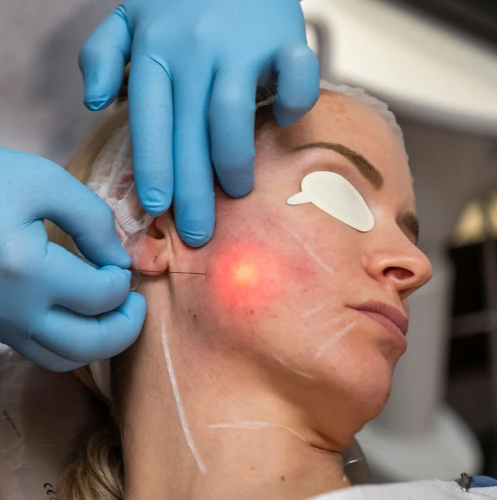 Endoface & Bodylift